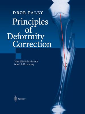 Principles of Deformity Correction - J. E. Herzenberg