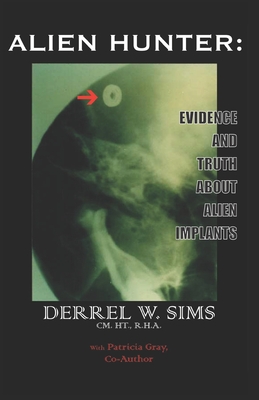 Alien Implants: Evidence & Truth about Alien Implants - Derrel W. Sims