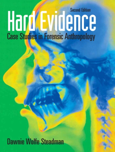 Hard Evidence: Case Studies in Forensic Anthropology - Dawnie Wolfe Steadman