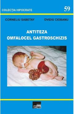 Coperta cărții Antiteza omfalocel gastroschizis