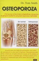Coperta cărții 'Osteoporoza - Tom Smith'