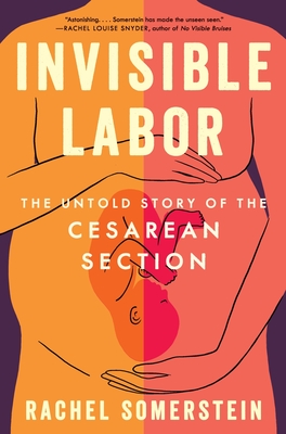 Invisible Labor: The Untold Story of the Cesarean Section - Rachel Somerstein