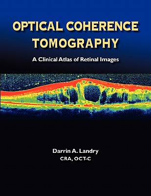 Optical Coherence Tomography a Clinical Atlas of Retinal Images - Darrin A. Landry