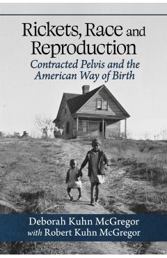 Coperta cărții 'Rickets, Race and Reproduction: Contracted Pelvis and the American Way of Birth - Deborah Kuhn Mcgregor'