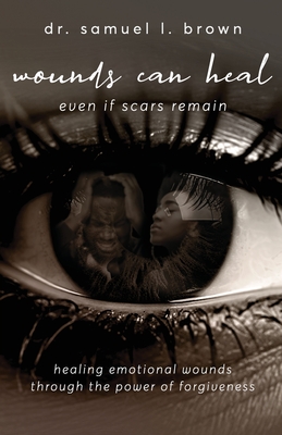 Coperta cărții 'Wounds Can Heal, Even If Scars Remain - Samuel Brown'