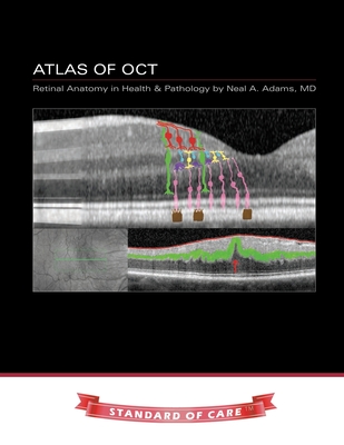 Atlas of OCT: Retinal Anatomy in Health & Pathology - Neal Adams