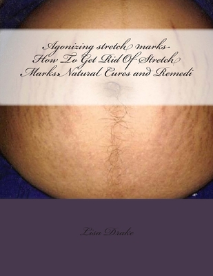 Agonizing stretch marks-How To Get Rid Of Stretch Marks: Natural Cures and Remedi - Lisa Drake