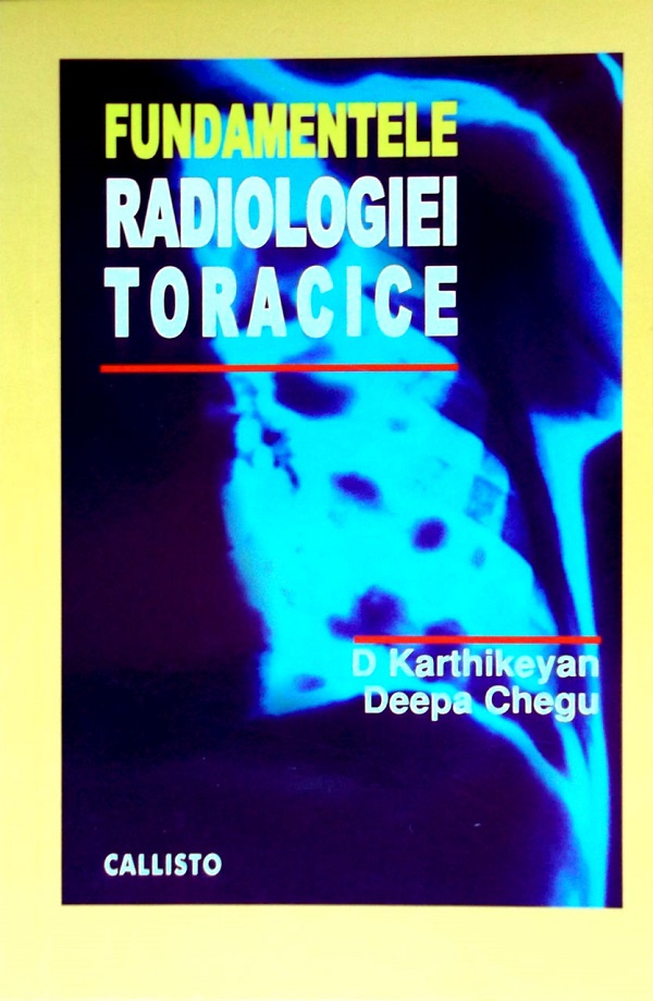 Fundamentele radiologiei toracice - D. Karthikeyan, Deepa Chegu