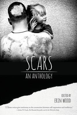 Scars: An Anthology - Erin Wood