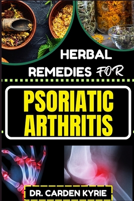 Herbal Remedies for Psoriatic Arthritis: Empower Your Journey To Wellness With Herbs For Alleviating Pain, Restoring Joint Health And Nurturing Overal - Carden Kyrie