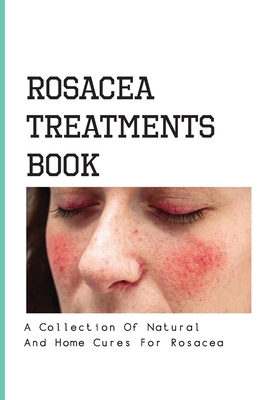 Rosacea Treatments Book- A Collection Of Natural And Home Cures For Rosacea: Rosacea Treatment - Merlin Diskind