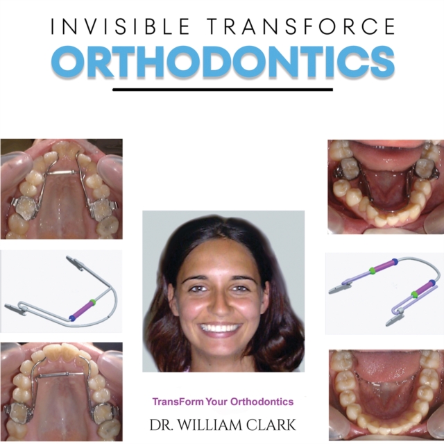 Invisible TransForce Orthodontics - William Clark