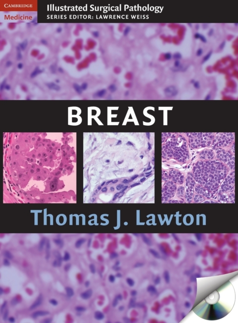 Illustrated Surgical Pathology of the Breast [With CDROM] - Thomas Lawton