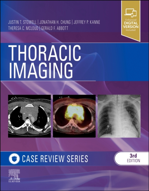Thoracic Imaging: Case Review - Justin T. Stowell