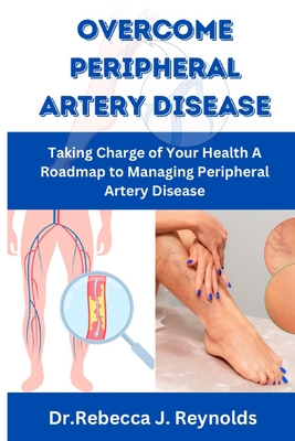 Overcome Peripheral Artery Disease: Taking Charge of Your Health A Roadmap to Managing Peripheral Artery Disease - Dr Rebecca J. Reynolds