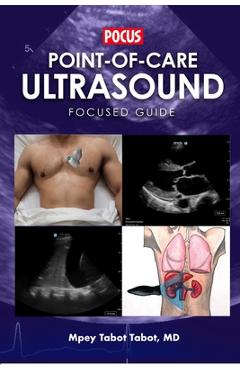 Coperta cărții 'Point-Of-Care Ultrasound Focused Guide - Alem Mehari'