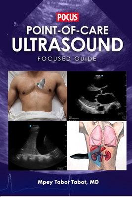 Point-Of-Care Ultrasound Focused Guide - Alem Mehari