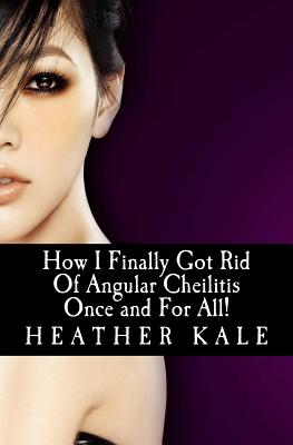 How I Finally Got Rid Of Angular Cheilitis Once and For All!: Cracked Mouth Corners No More - Petra Ortiz