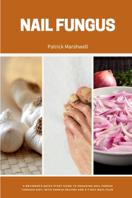 Nail Fungus: A Beginner's Quick Start Guide to Managing Nail Fungus Through Diet, With Sample Recipes and a 7-Day Meal Plan - Patrick Marshwell
