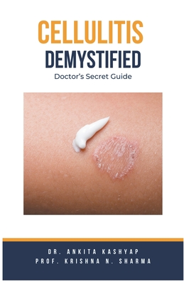 Cellulitis Demystified: Doctor's Secret Guide - Ankita Kashyap