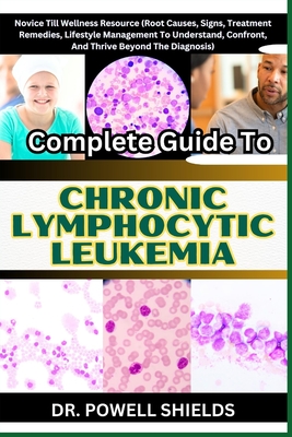 Complete Guide To CHRONIC LYMPHOCYTIC LEUKEMIA: Novice Till Wellness Resource (Root Causes, Signs, Treatment Remedies, Lifestyle Management To Underst - Powell Shields