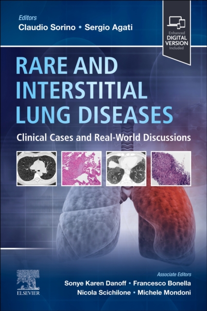 Rare and Interstitial Lung Diseases: Clinical Cases and Real-World Discussions - Claudio Sorino