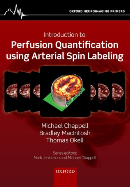 Introduction to Perfusion Quantification Using Arterial Spin Labelling - Michael Chappell