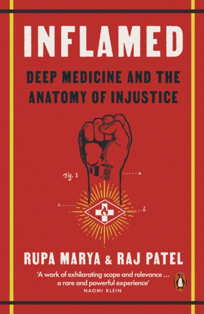 Inflamed - Rupa|patel Marya