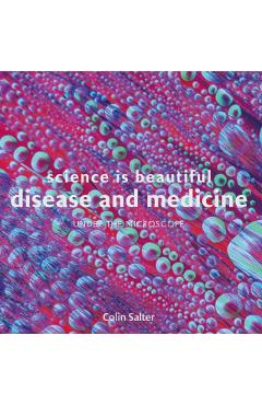 Coperta cărții 'Science is Beautiful: Disease and Medicine - Colin Salter'