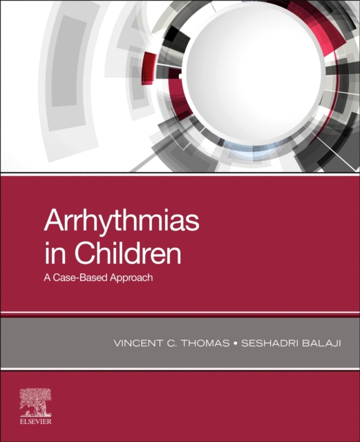 Arrhythmias in Children - Vincent C. Thomas