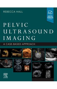Pelvic Ultrasound Imaging -