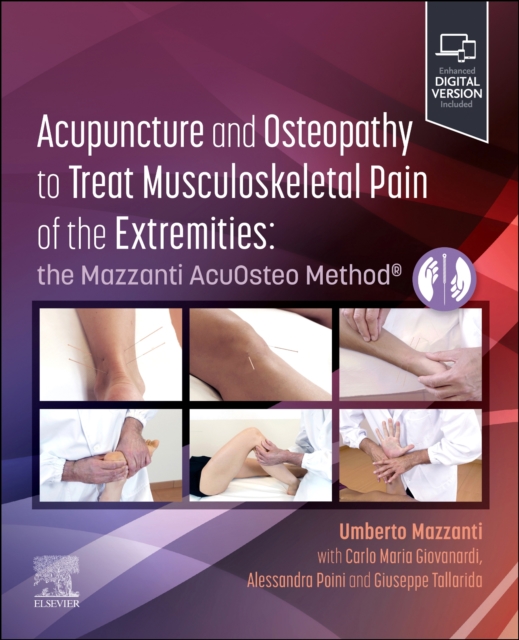 Acupuncture and Osteopathy to Treat Musculoskeletal Pain of the Extremities - Umberto Mazzanti