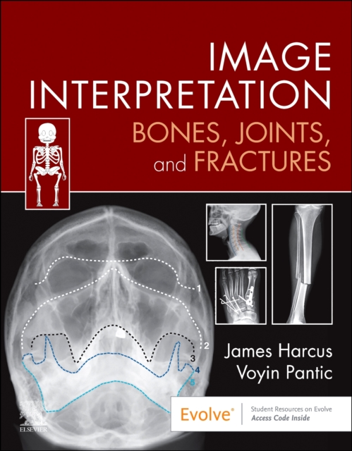 Image Interpretation: Bones, Joints, and Fractures - James (lecturer In Diagnostic Imaging Harcus