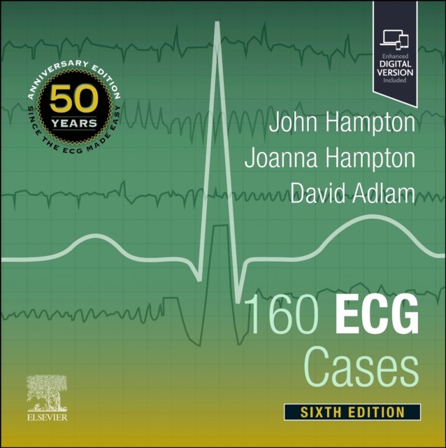 160 ECG Cases - John (emeritus Professor Of Cardiology Hampton
