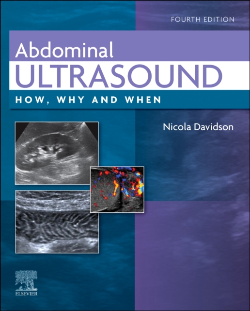 Abdominal Ultrasound - 