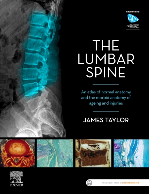 Lumbar Spine - James Taylor