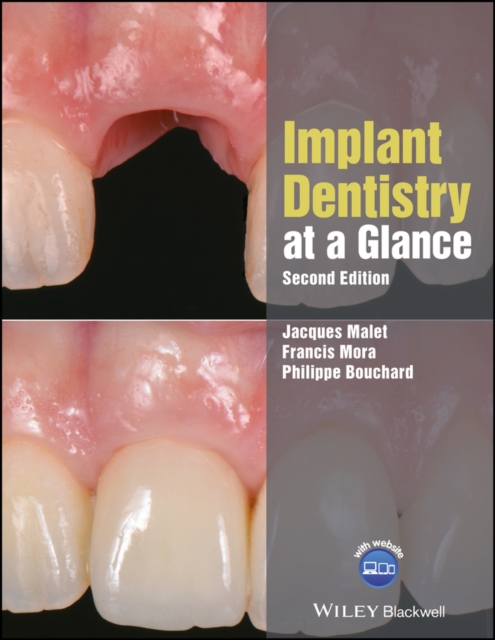 Implant Dentistry at a Glance - Jacques ( assistant Professor Of Clinical Dentistry Malet