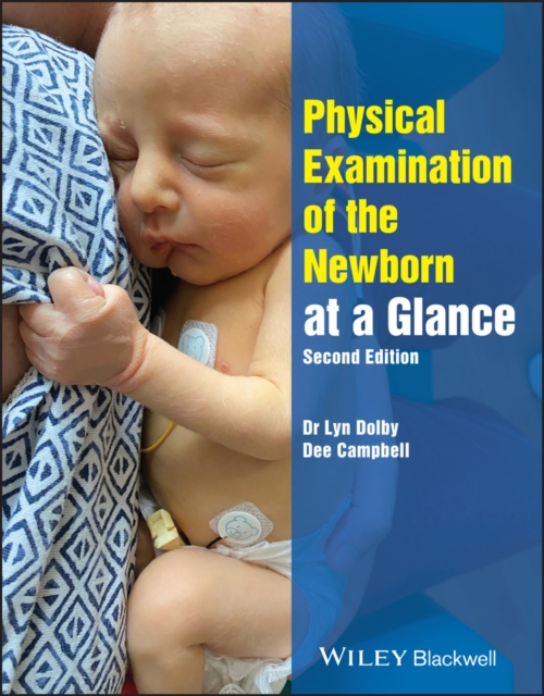Physical Examination of the Newborn at a Glance - Lyn (northampton University Dolby
