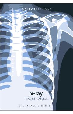 Coperta cărții 'X-ray - Dr. Nicole (assistant Professor Of English Lobdell'