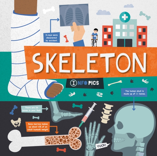 Skeleton - Harriet Brundle