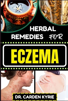 Coperta cărții 'Herbal Remedies for Eczema: Unlocking Nature's Healing Power With Herbs For Flourishing Skin, Holistic Wellness,'