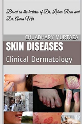 Skin Diseases: Clinical Dermatology - Chuadhary Murtaza