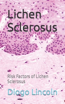 Lichen Sclerosus: Risk Factors of Lichen Sclerosus - Diogo Lincoln