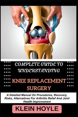 Complete Guide to Understanding Knee Replacement Surgery: A Detailed Manual On Procedures, Recovery, Risks, Alternatives For Arthritis Relief And Join - Klein Hoyle