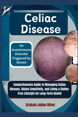 Coperta cărții 'Celiac Disease: An Autoimmune Disorder Triggered by Gluten: Comprehensive Guide to Managing Celiac Disease, Gluten'