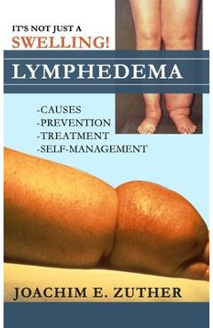 Coperta cărții 'It's Not Just a Swelling! Lymphedema: Causes, Prevention, Treatment, Self-Management - Joachim Zuther'