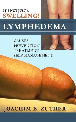 It's Not Just a Swelling! Lymphedema: Causes, Prevention, Treatment, Self-Management - Joachim Zuther