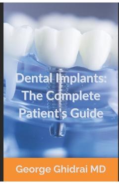 Coperta cărții 'Dental Implants: The Complete Patient's Guide - George Ghidrai'