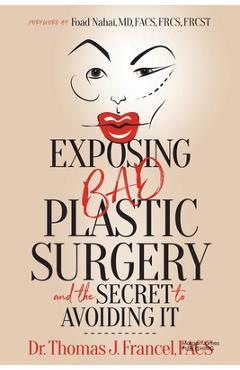 Coperta cărții 'Exposing Bad Plastic Surgery: And the Secret to Avoiding It - Thomas J. Francel'
