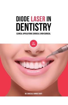 Poza produsului Diode Laser In Dentistry - Clinical Applications Surgical & Non Surgical (Full Colour) - Ghazala Ahmed Shafi